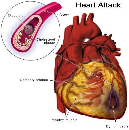 cholesterol.jpg
