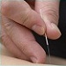 Acupuncture Facts