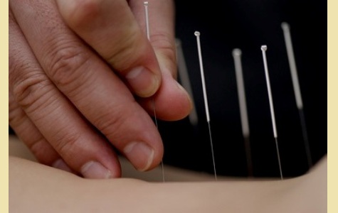 Acupuncture Doctors in Nizamabad