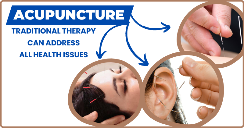 Acupuncture Doctors in New Jersey