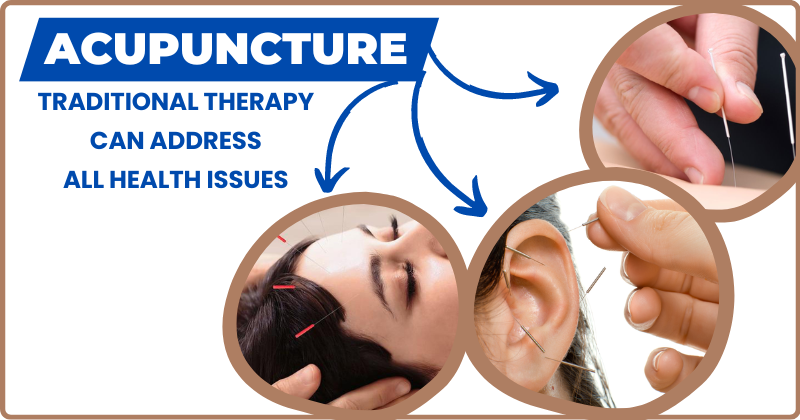 Acupuncture Doctors in Nagpur