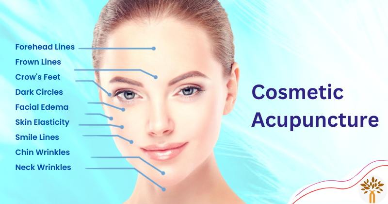 Cosmetic Acupuncture