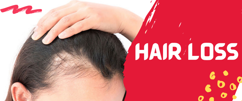 Hairloss Treatment In Andheri