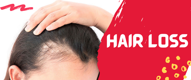 Hairloss Treatment In Sharjah