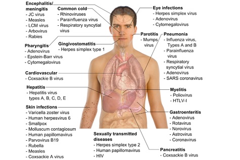 Infections Treatment in Mysore