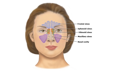 Sinusitis Treatment in 