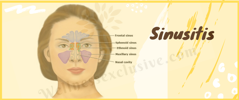 Sinusitis Treatment in Visakhapatnam